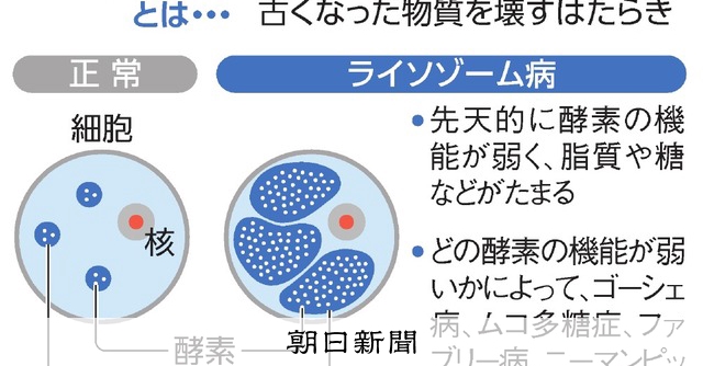 患者を生きる：4425）ライソゾーム病と新薬：5 情報編 酵素補充