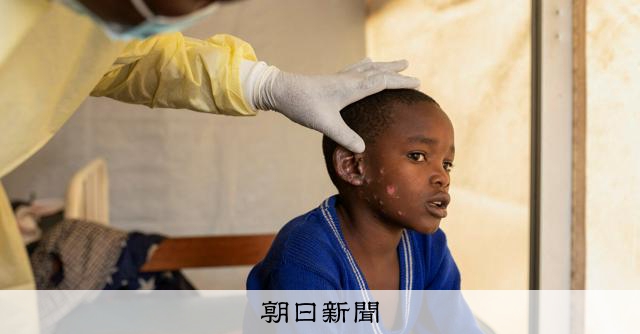 WHO、エムポックスの感染拡大で「緊急事態」宣言 22年7月以来