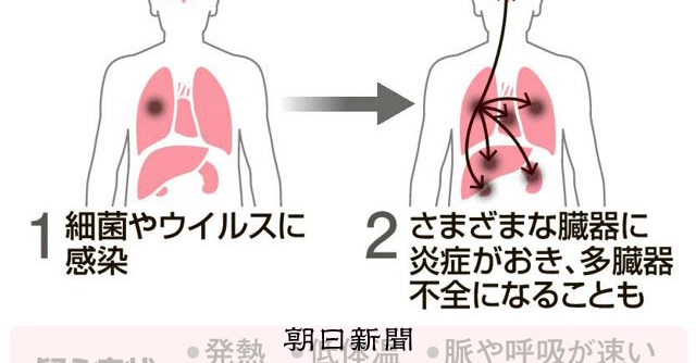 敗血症とは 世界で5人に1人の死因、細菌やウイルス感染が原因