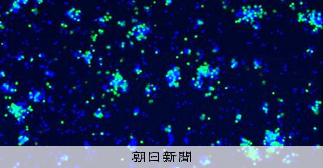 難病の血管炎、異常に活性化する免疫細胞を発見、再発予測へ 阪大