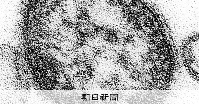 はしか患者200人超、前年比3.5倍　コロナ以降最多　強い感染力 
 
麻疹（はしか）の患者が増えている。国立健康危機管理研究機構の14日の発表によると、今年に入り計236人（5日までの速報値）が報告され、前年の同じ時期に比べ3.5倍になっている。