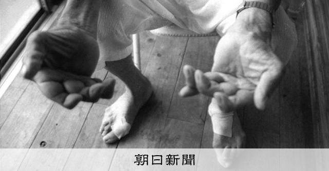 RT @okitsuhiroki: 水俣病「未解決」への思い、線引きの内実　公式確認70年アンケート


水俣病が公式に確認されてから、あすで70年になります。アンケートからは、いまなお解決していない現状が浮かびました。