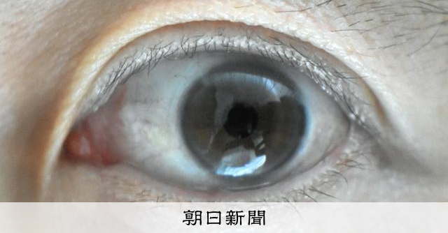 熱中症になると白内障リスク1.96倍　レンズが熱変性？名工大研究 
 
熱中症になったことがある人は、そうでない人より白内障を発症するリスクが1.96倍に高まるという研究結果を、名古屋工業大学の平田晃正教授（医用工学）が発表した。