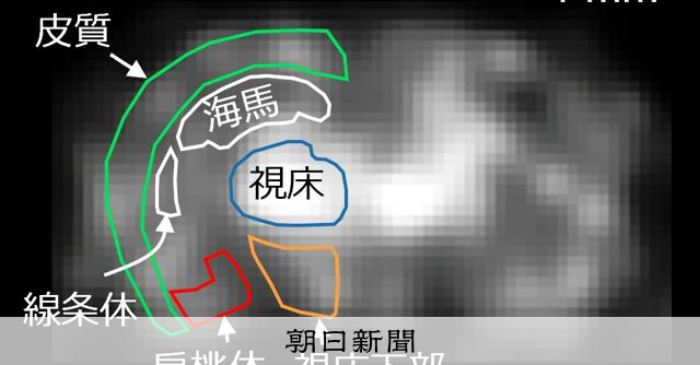 生きたマウスの脳、0.5ミリまで見える装置　臨床への応用に期待 
 
生きたままのマウスの脳を、0.5ミリの細かな構造まで見ることに成功したと量子科学技術研究開発機構（QST）のチームが発表した。