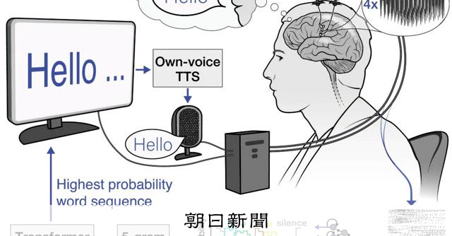 脳と機械つなげて「会話」、ALS患者が自宅で約2年 米チーム実証:朝日新聞